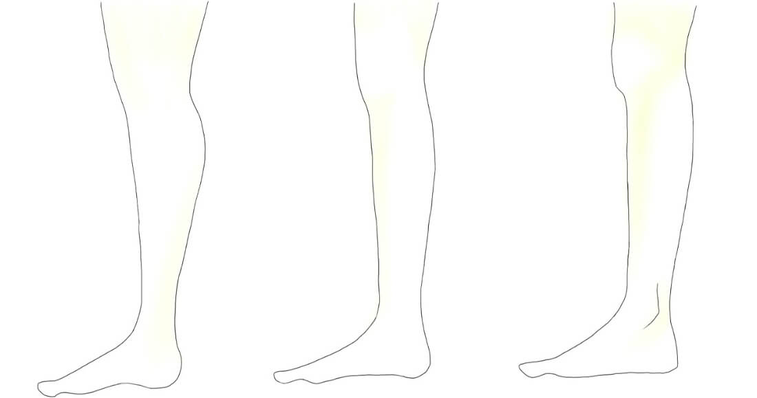 太もも～膝下の特徴は？